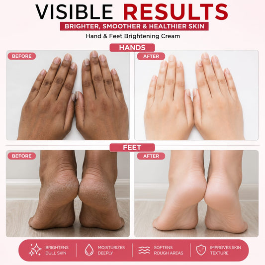 Hand & Foot Brightening Cream | Removes Dark Spots & Smooths Rough Skin