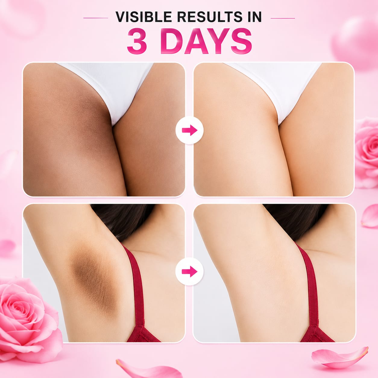 Private parts and Underarm whitening Cream
