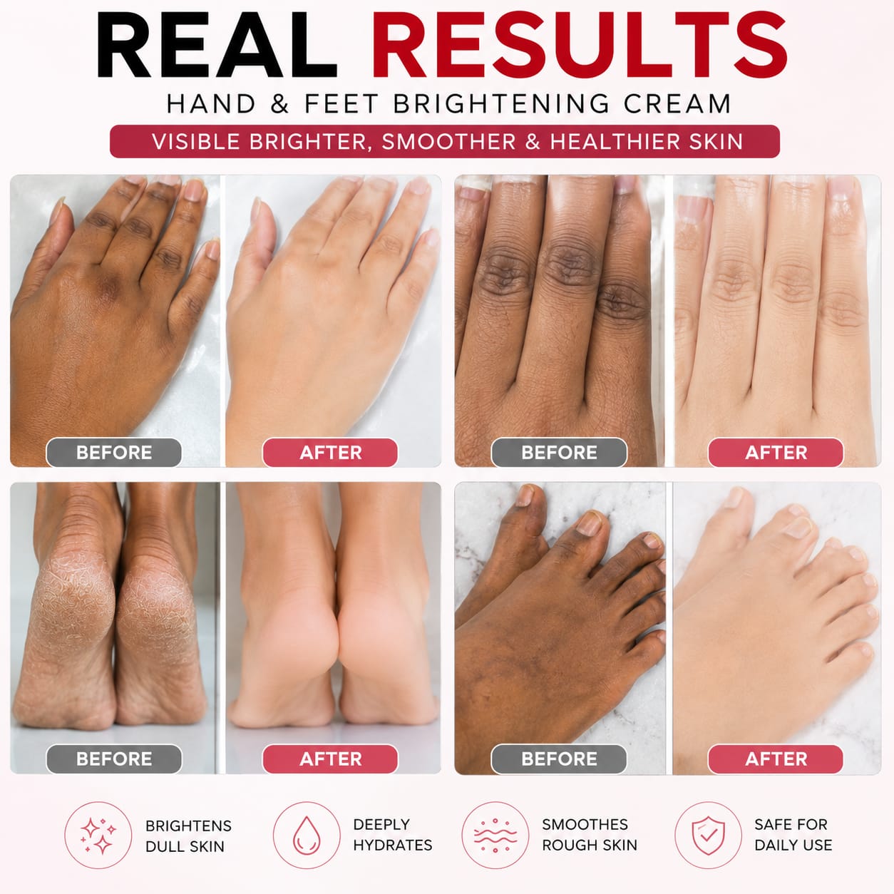 AVEESSENCE Hand & Foot Brightening Cream | Removes Dark Spots & Smooths Rough Skin