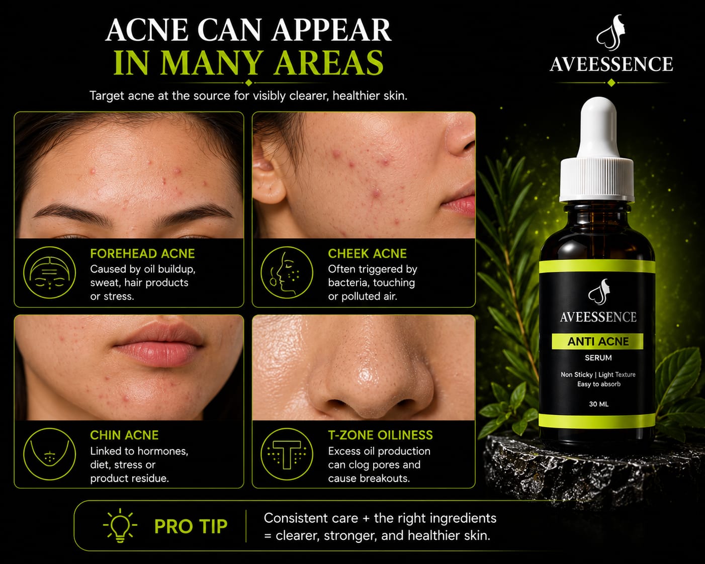 AVVEESENCE Clear, Calm & Acne-Free Skin Advanced Salicylic Acid Serum for Stubborn Breakouts