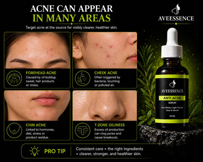 AVVEESENCE Clear, Calm & Acne-Free Skin Advanced Salicylic Acid Serum for Stubborn Breakouts