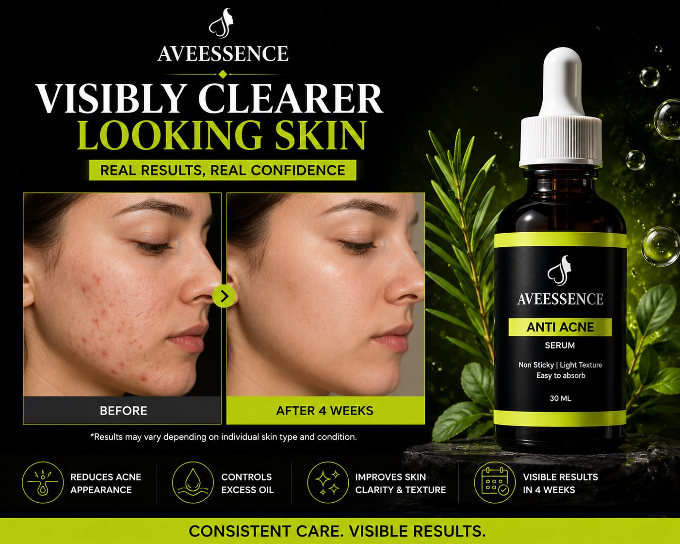 AVVEESENCE Clear, Calm & Acne-Free Skin Advanced Salicylic Acid Serum for Stubborn Breakouts