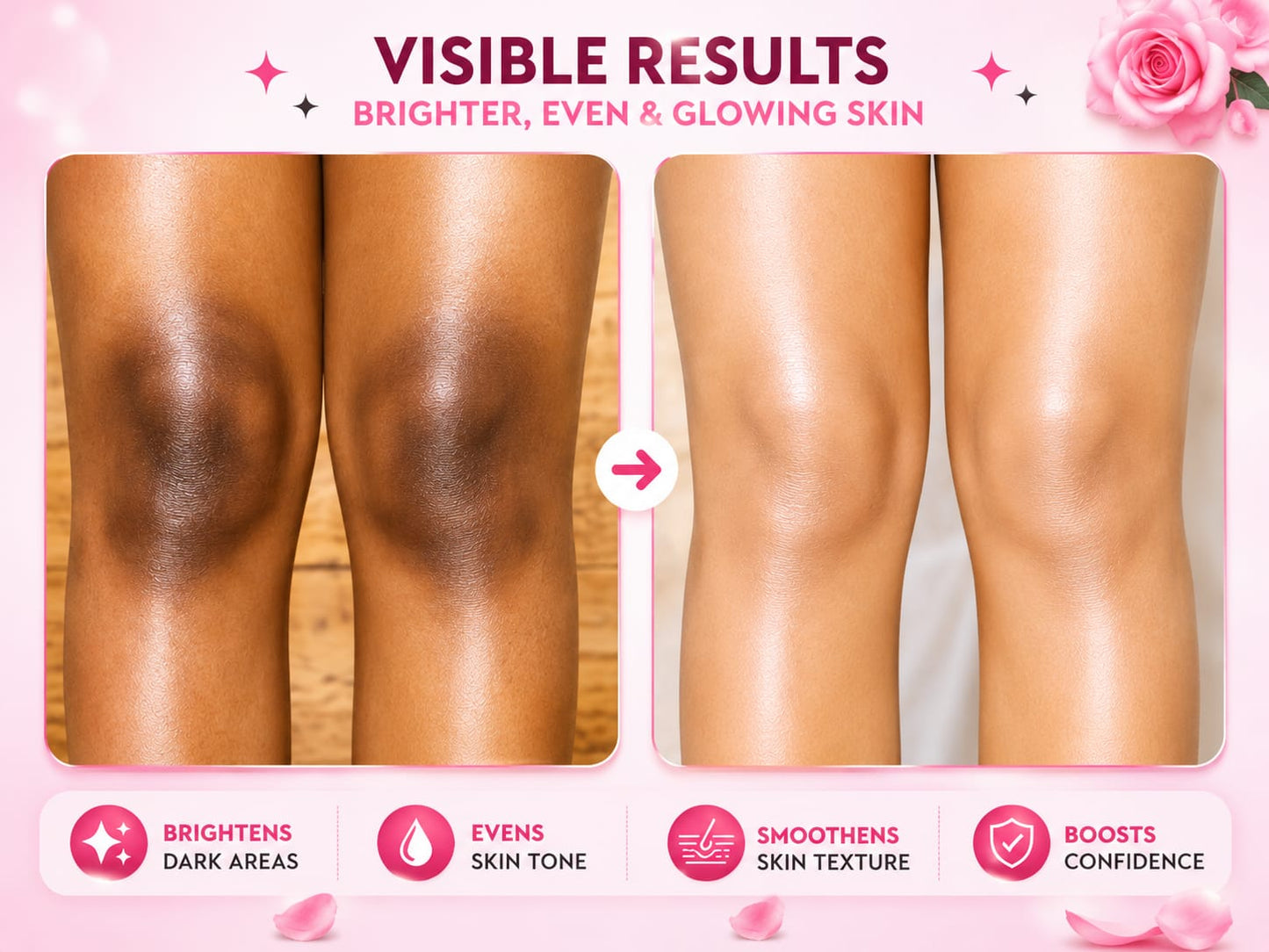 Private parts and Underarm whitening Cream