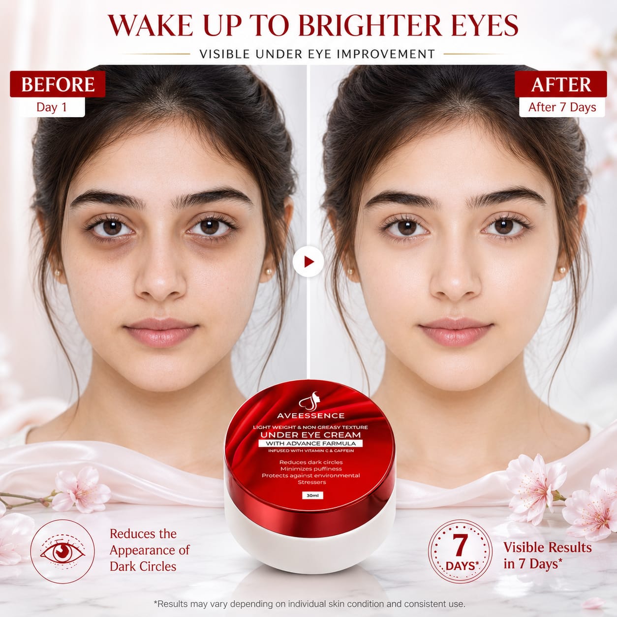 Removes Dark Circules and Brightens Under Eye Skin in 7 days