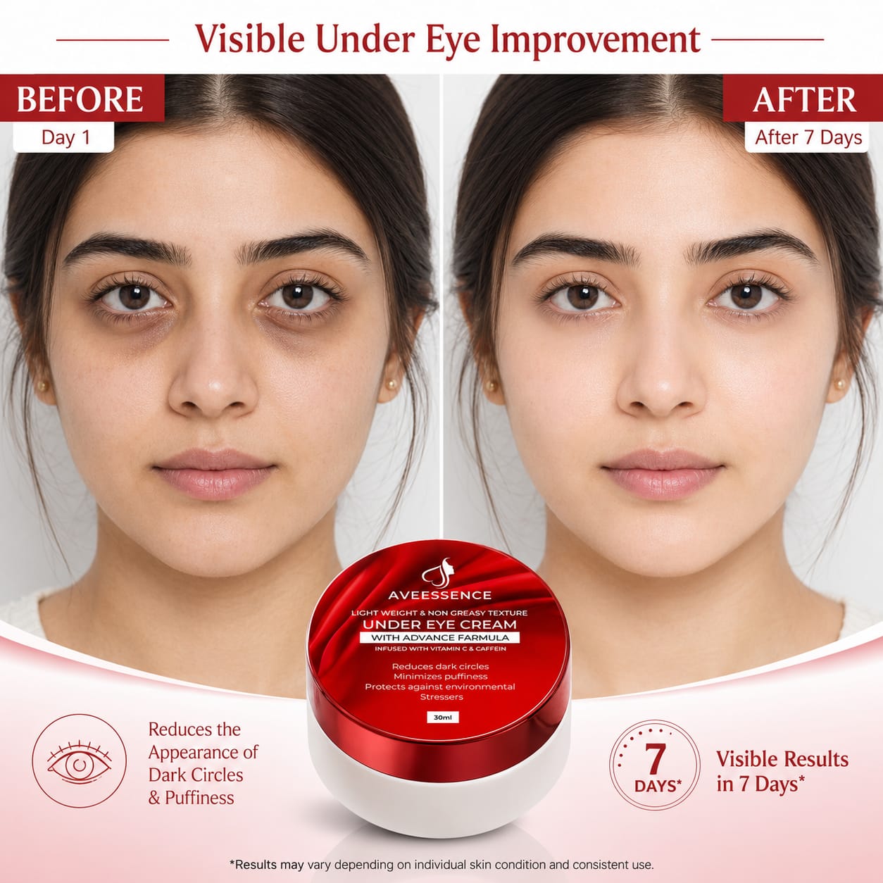 Removes Dark Circules and Brightens Under Eye Skin in 7 days