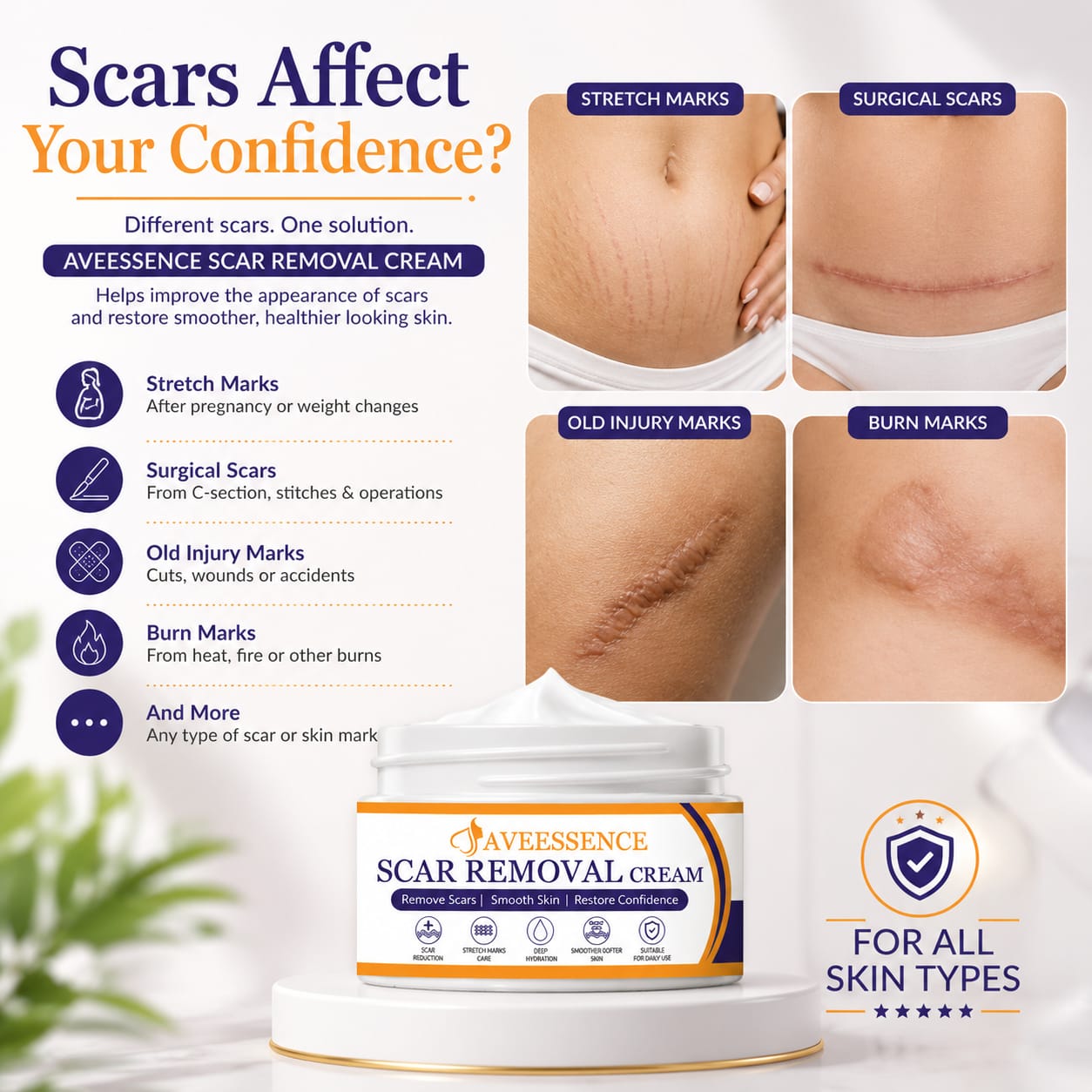 Scars Removal Cream  Helps Reduce Stretch Marks & Scars in 7 Days