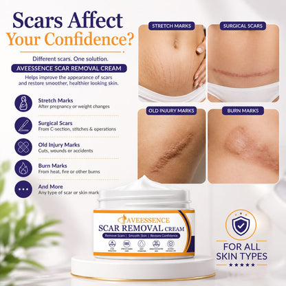 Scars Removal Cream  Helps Reduce Stretch Marks & Scars in 7 Days