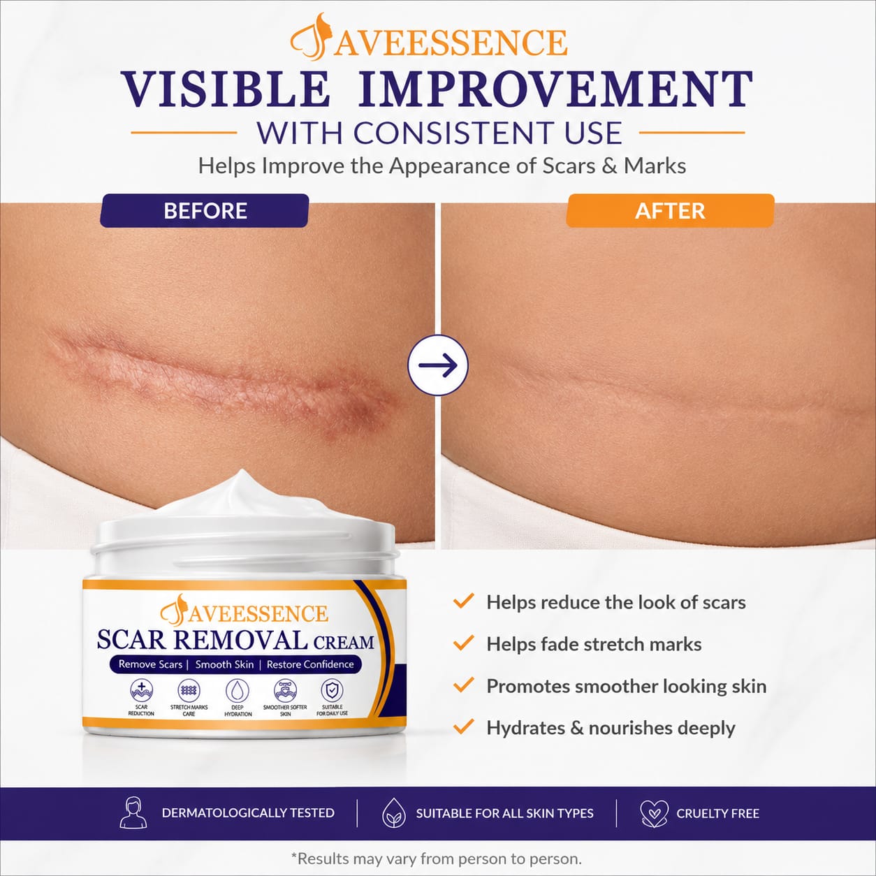 Scars Removal Cream  Helps Reduce Stretch Marks & Scars in 7 Days