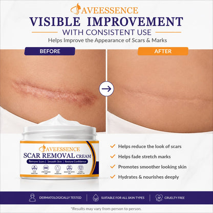 Scars Removal Cream  Helps Reduce Stretch Marks & Scars in 7 Days
