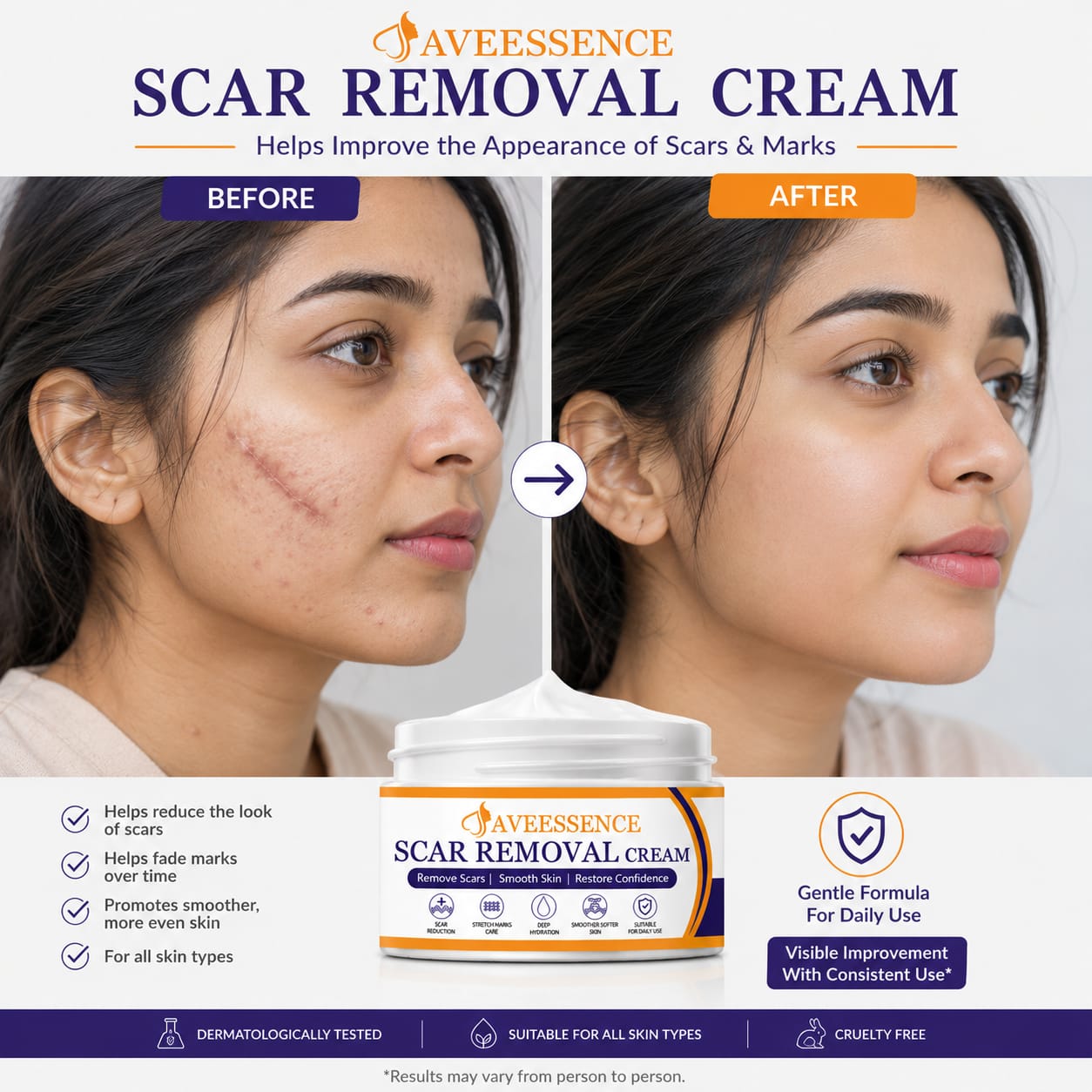 Scars Removal Cream  Helps Reduce Stretch Marks & Scars in 7 Days