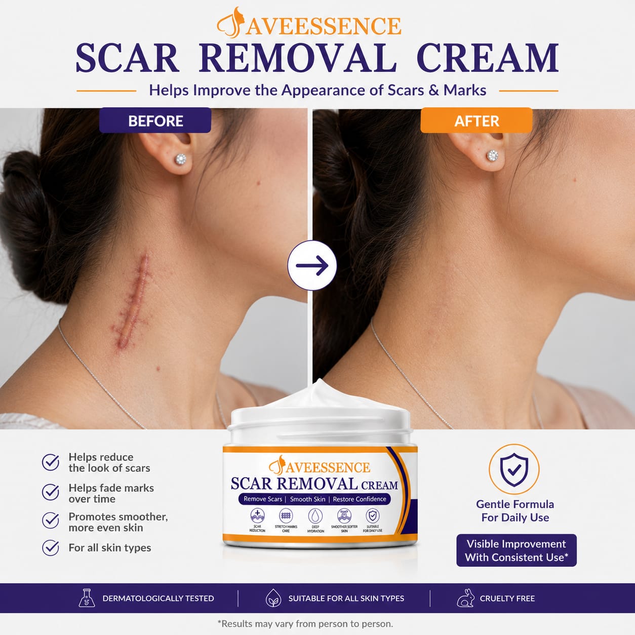 Scars Removal Cream  Helps Reduce Stretch Marks & Scars in 7 Days