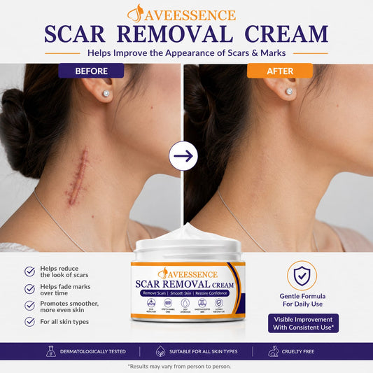 Scars Removal Cream  Helps Reduce Stretch Marks & Scars in 7 Days
