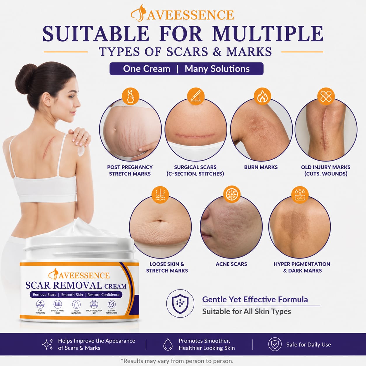 Scars Removal Cream  Helps Reduce Stretch Marks & Scars in 7 Days
